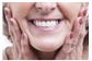 Implantes Dentários
