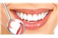 Clareamento Dentário no Bairro de Fátima