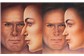 Cirurgia Plástica do Nariz ou Rinoplastia