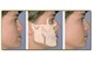 Cirurgia Buco-Maxilo-Facial no Bairro de Fátima