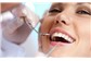 Limpeza Dentária no Tauape 